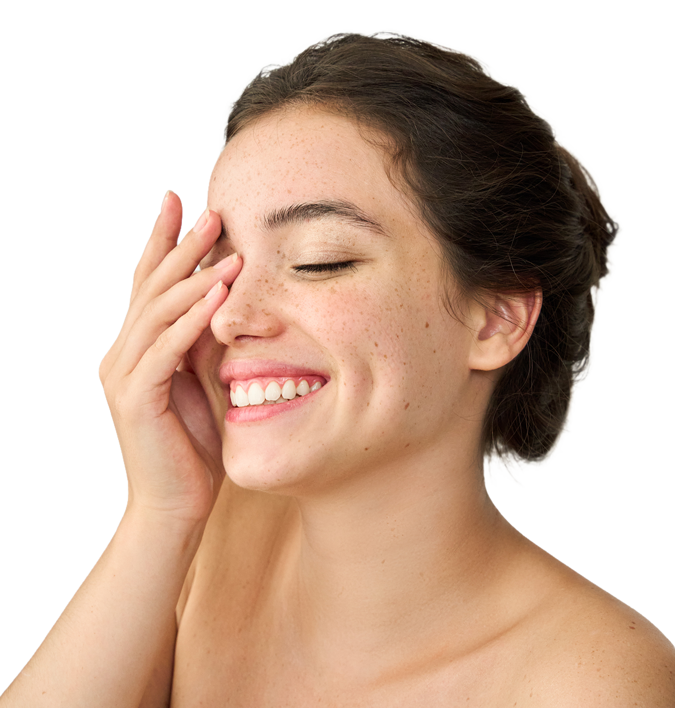 Women smiling covering one eye with her hand.